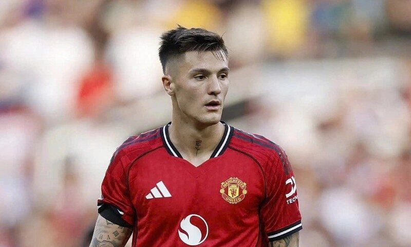 Sesko nghỉ dài hạn vì chấn thương